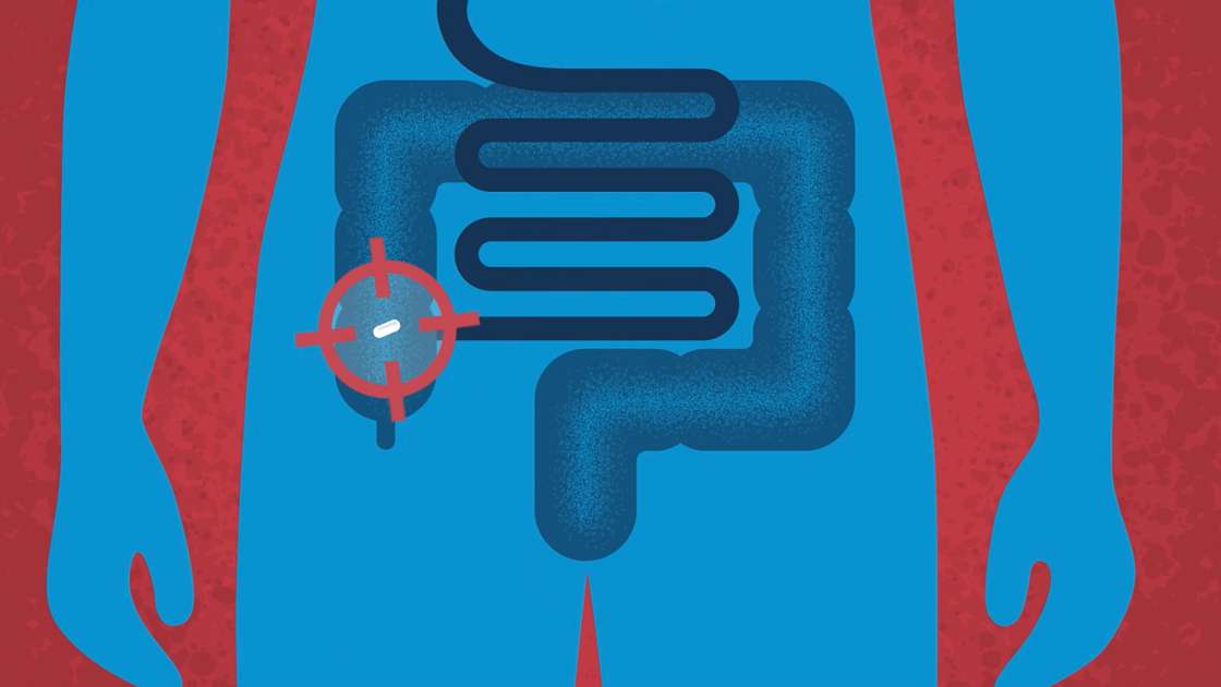 An animated image showing a colon inside the human body with the infliximab capsule inside it. An animated image showing a colon inside the human body with the infliximab capsule inside it.