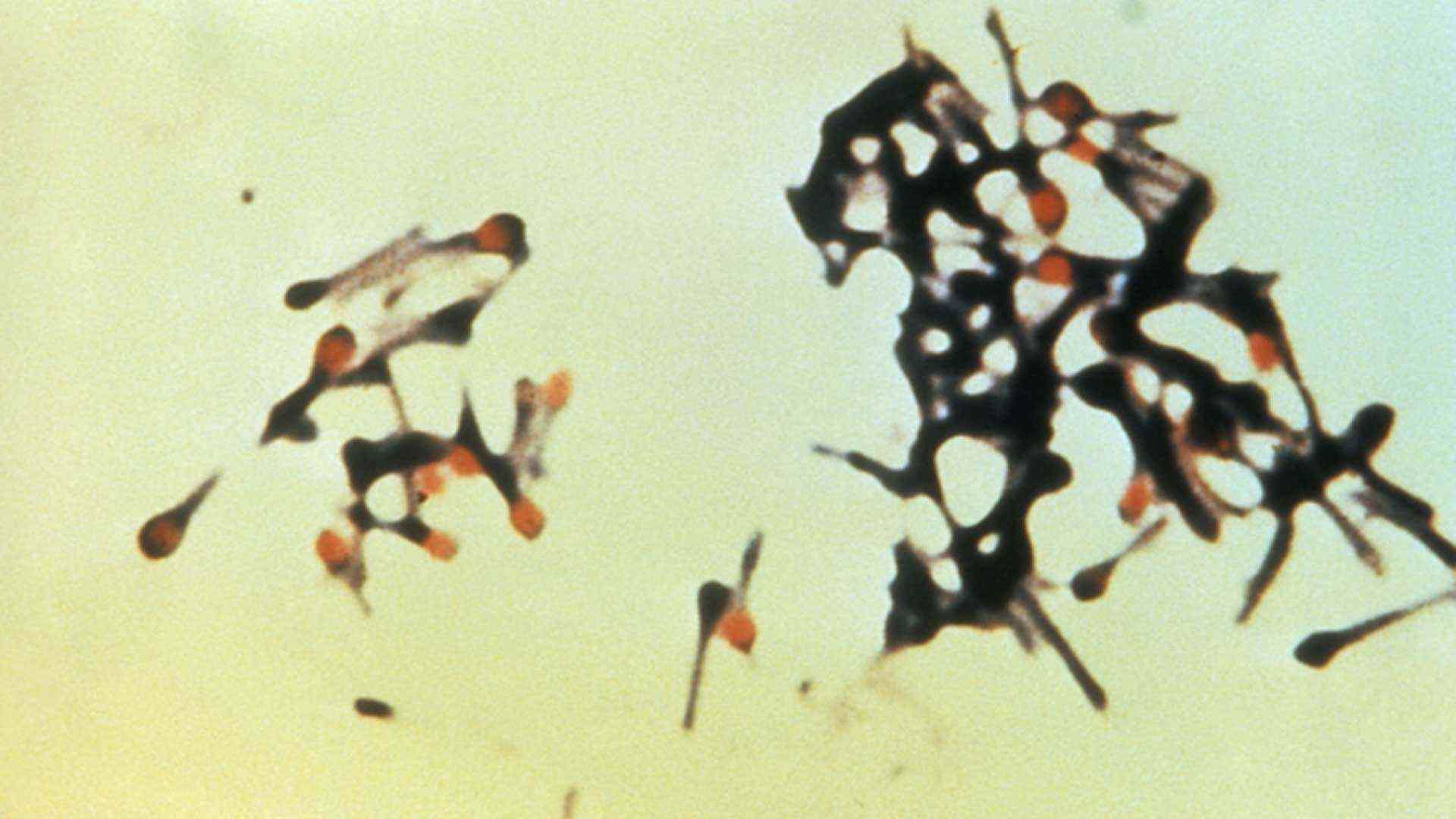 Micrograph depicting a group of fatal bacteria - they could be destroyed by wavelengths of blue light Micrograph depicting a group of fatal bacteria - they could be destroyed by wavelengths of blue light